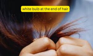 Read more about the article White Bulb at the End of Hair: Causes, Meaning, and How to Maintain